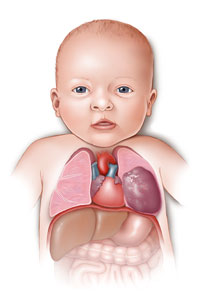 Congenital malformations of the respiratory system