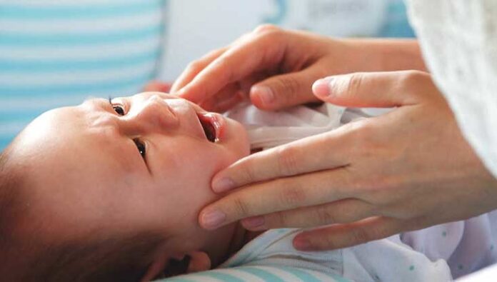 The most common birth defects in newborns